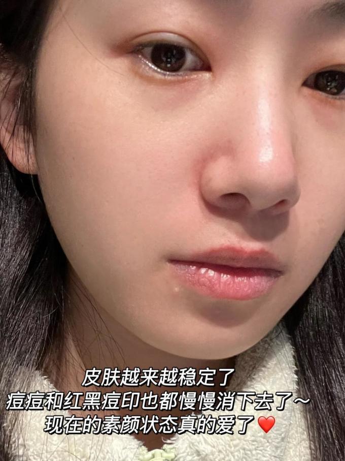 精华液
