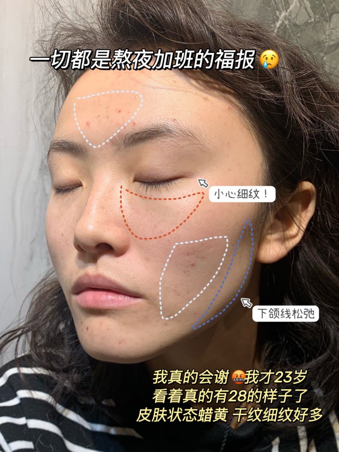 瑷尔博士精华液