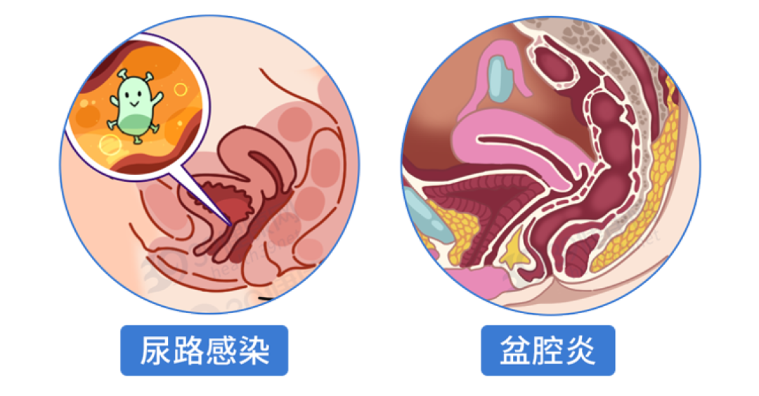 “阿莫西林”要认清,只对6种病有效!用对是宝,用错是害药
