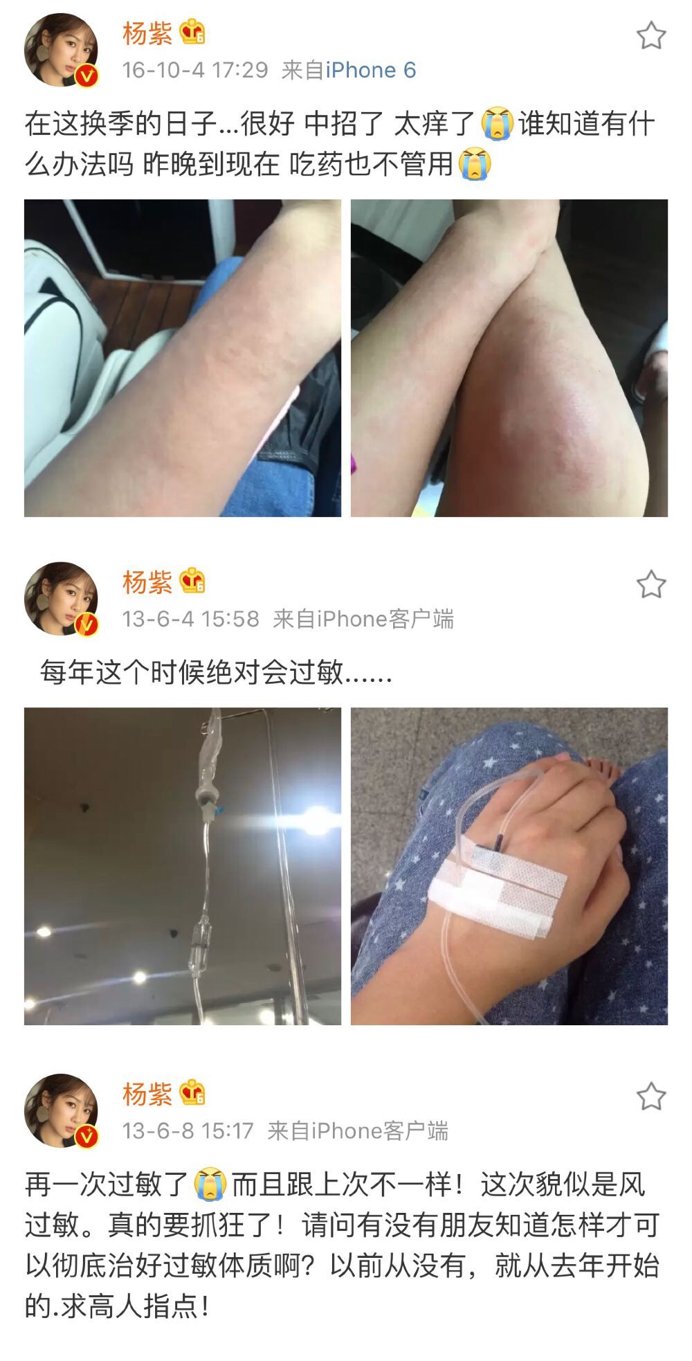 五花八门的过敏反应！春季肌肤又双叒叕“玻璃心”