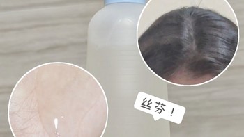 好用小杂货 篇五：头上不下白雪了！好清爽！