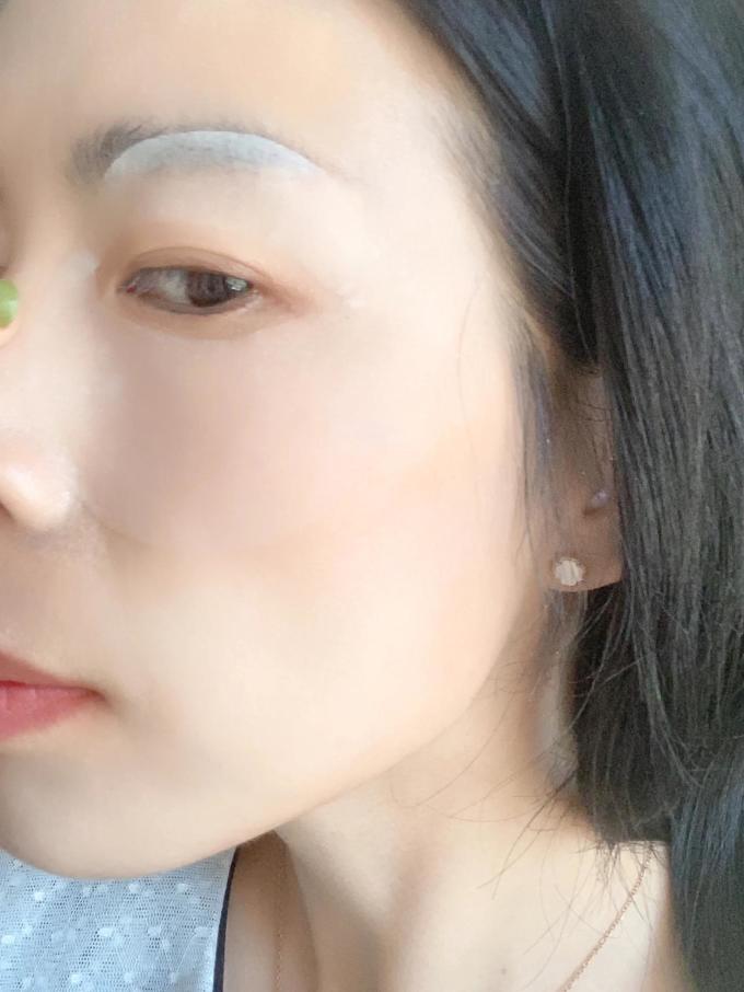 颈膜