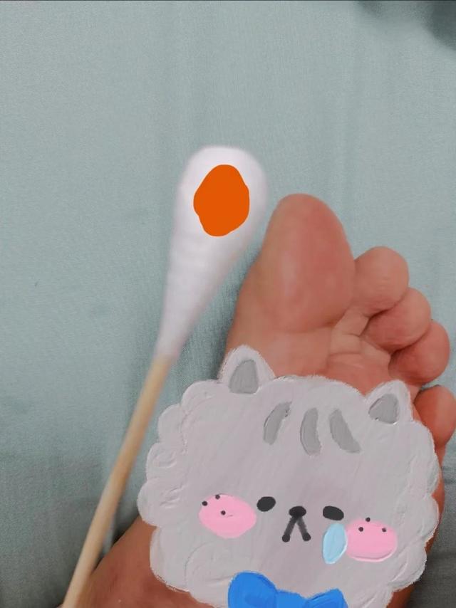 自己~自藏的治霉菌方法！真的好使！