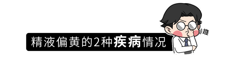 男生长期禁欲，精子质量是好是坏？提醒：精液出现3种颜色，或是疾病信号