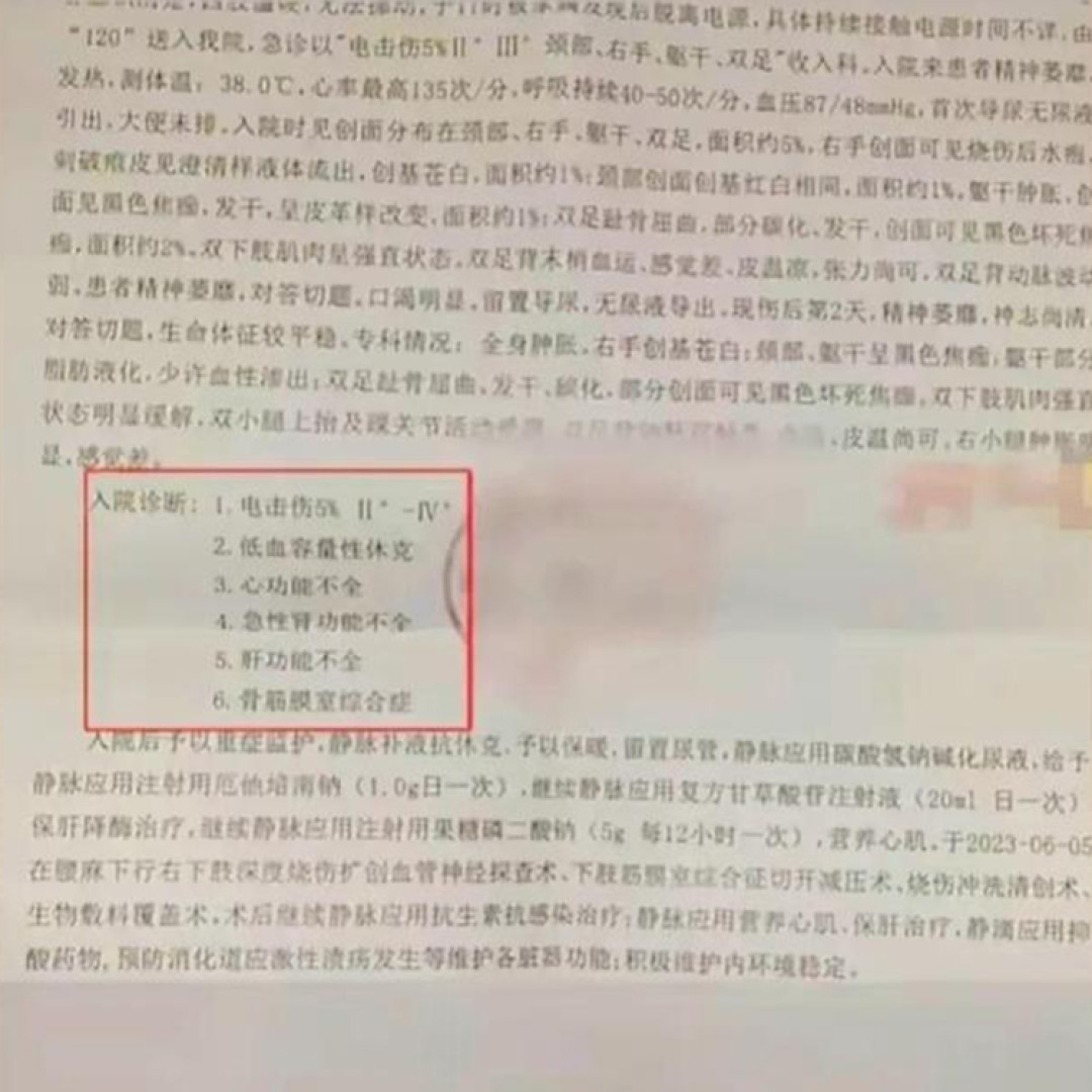 女孩用 iPhone 充电遭电击,苹果立即做出回应