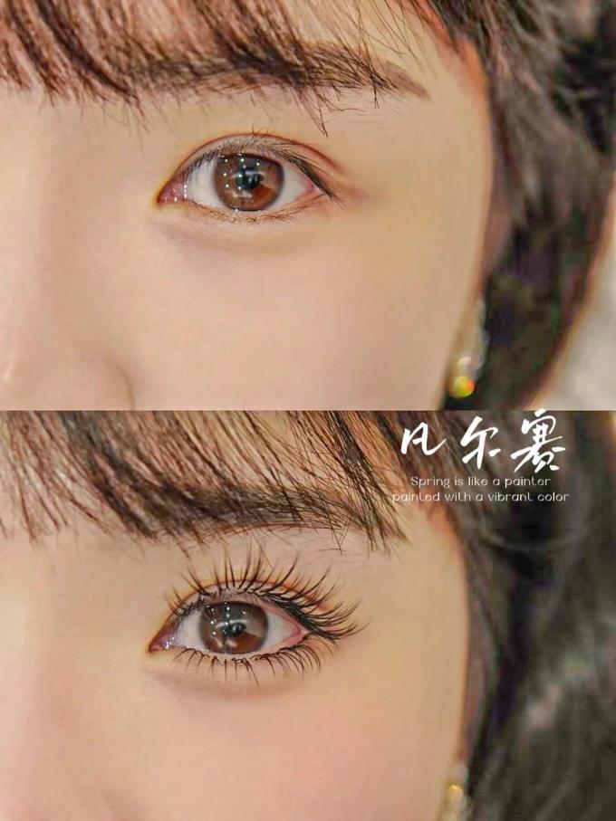 其他美容
