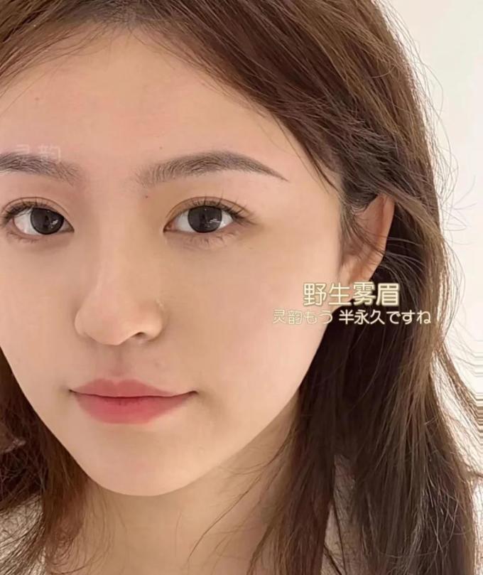其他美容