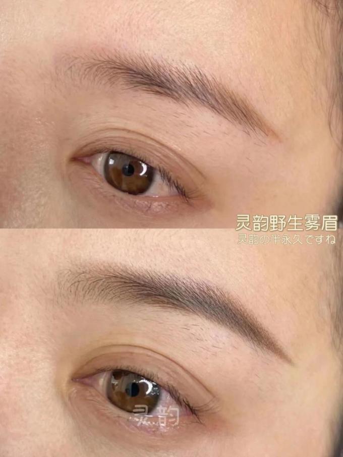 其他美容