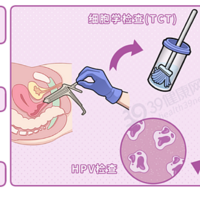 宫颈癌一发现就是晚期？私处出现3个异常，千万别大意