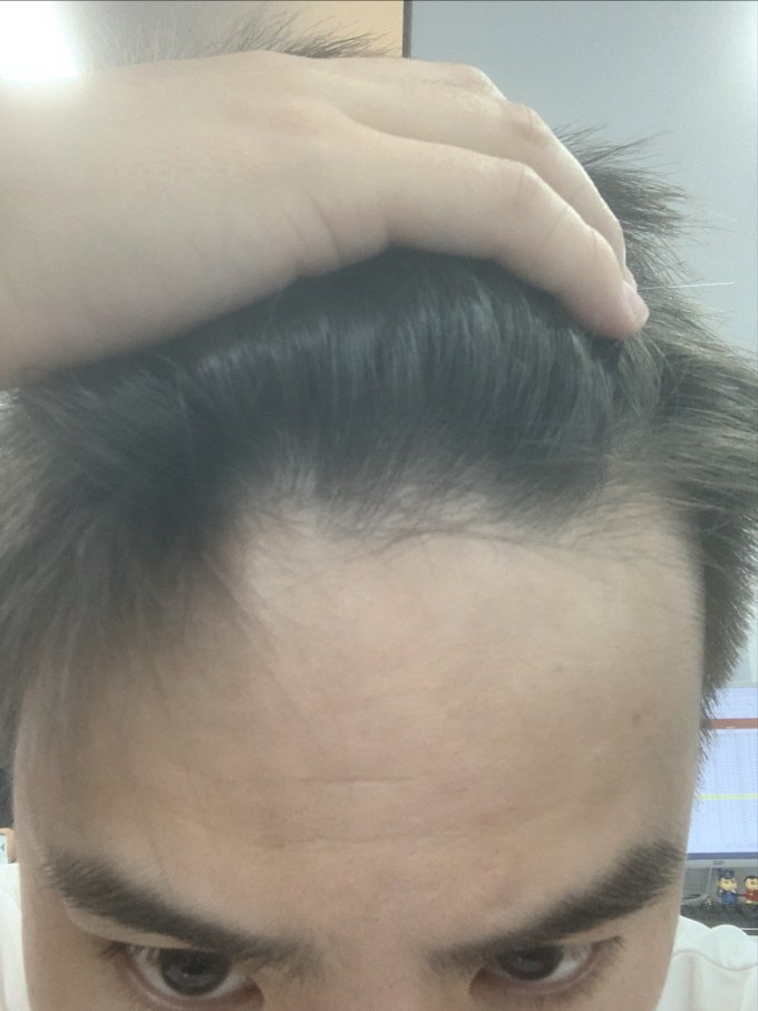 基础健康