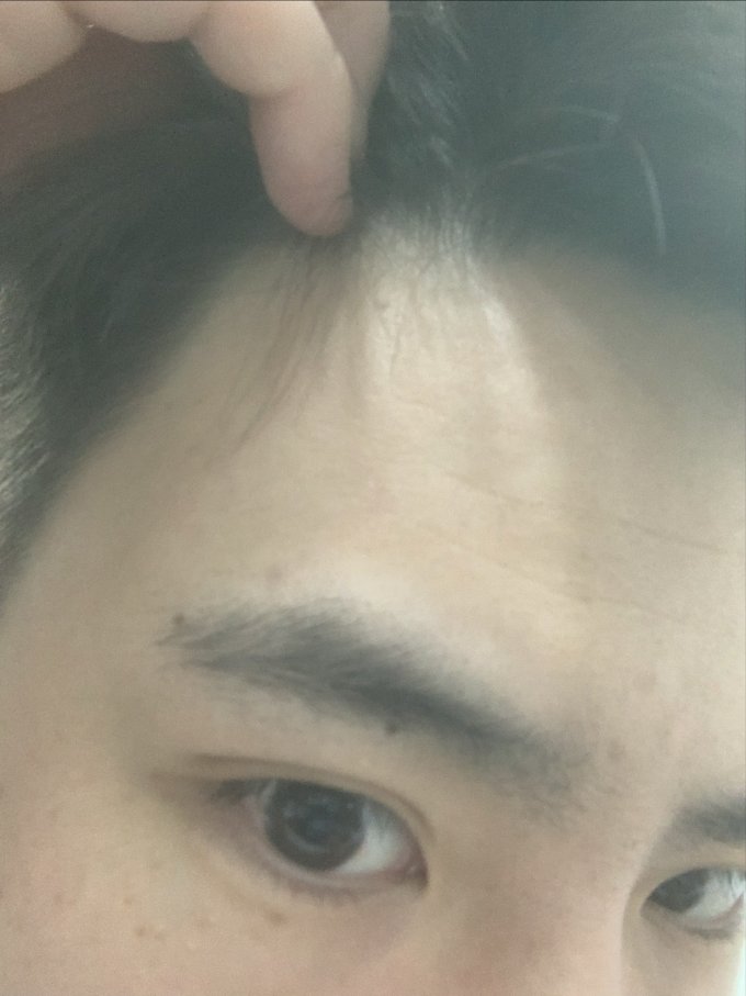 基础健康