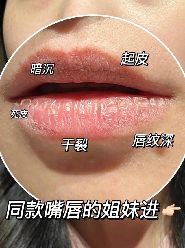 嘴巴干天天撕嘴皮？达咩❌润唇膏快用起来！