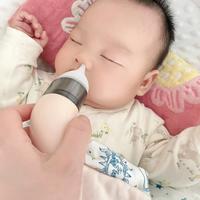 二阳！宝宝也水泥封鼻了
