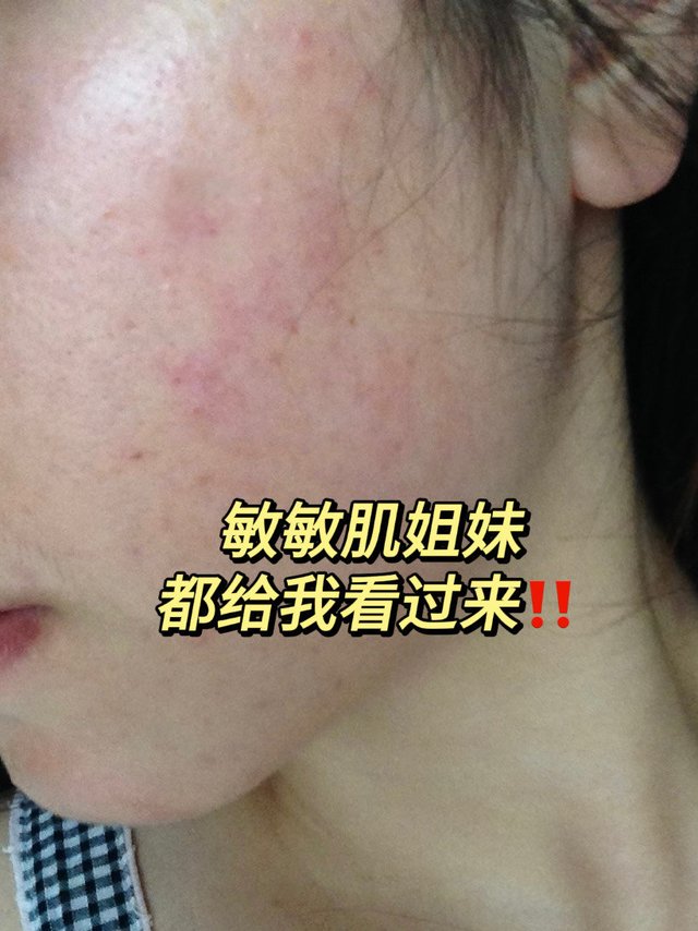 敏敏肌的这个护肤方法有点东西～亲测有效‼