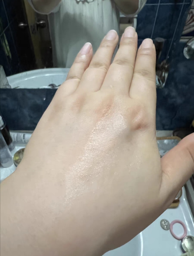 护肤精华