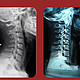 【颈椎曲度变直恢复全过程分享】一位颈椎疼痛患者的自述，面对颈椎曲线变直/反弓/富贵包时的做法~