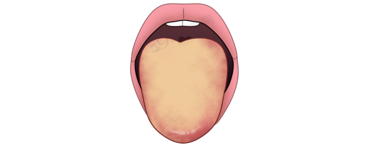 体内有癌，舌头先知？若舌头出现7种异常，当心癌症或疾病预警