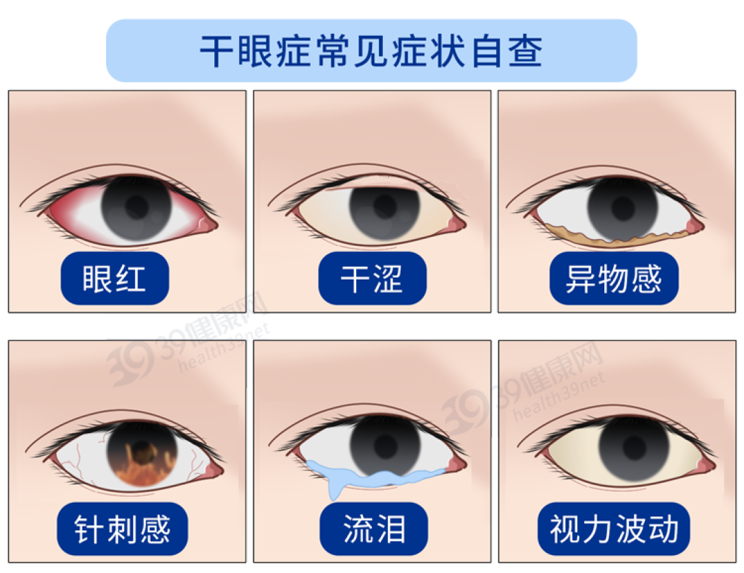 最伤眼的4个习惯，正慢慢毁掉你的眼睛！第一个你就中招了