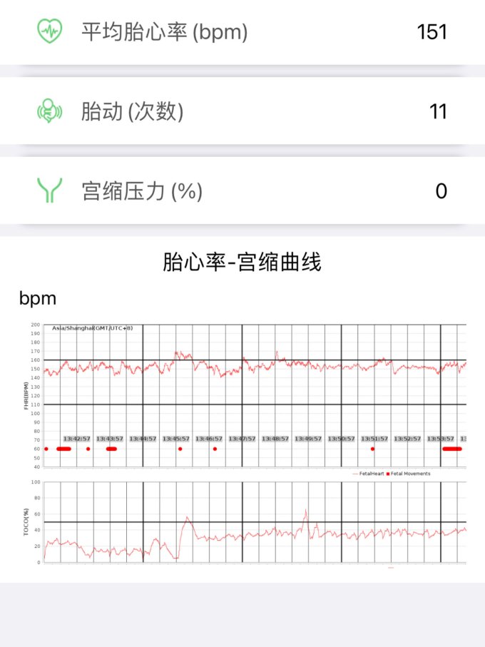 喜芽胎心仪