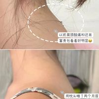 颈椎患者不可不用!躺着”枕“好!