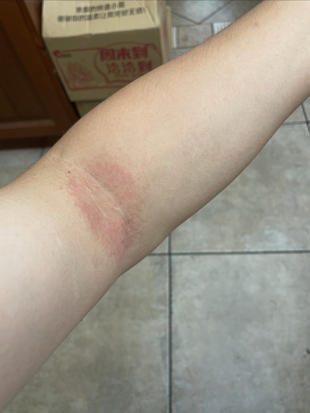 这是湿疹还是皮炎?