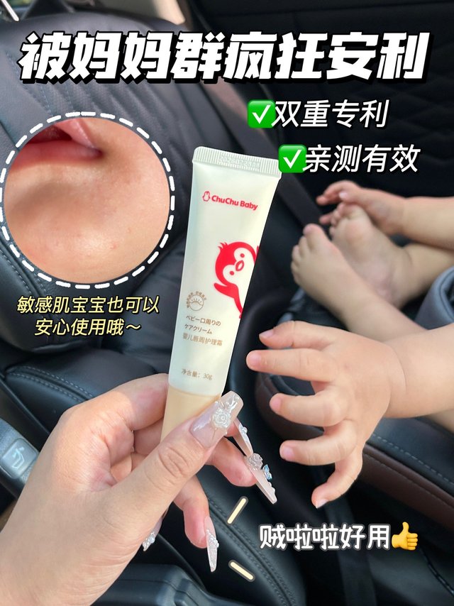 妈妈群里疯狂推荐的唇周膏！竟然这么好用！