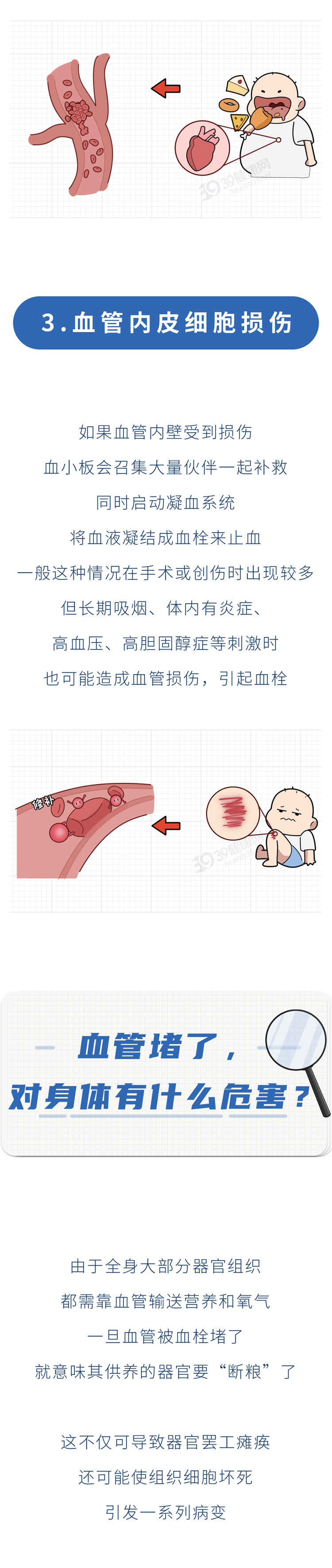 为什么中国心梗脑梗的人越来越多？3种食物容易让血管变堵，尽量少吃