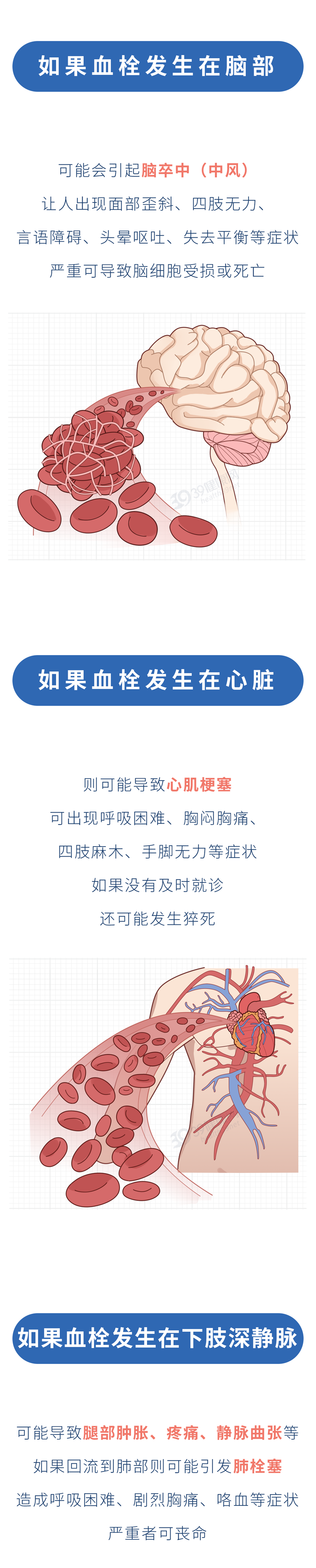 为什么中国心梗脑梗的人越来越多？3种食物容易让血管变堵，尽量少吃