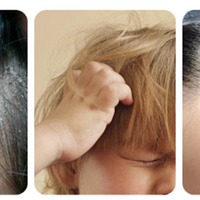 如何减少孩子头屑头痒？选对洗发水是关键