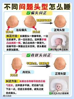 头型矫正，从小抓起㊙️终于把周状头睡成小