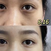 这玩意对黑眼圈杀疯了!!