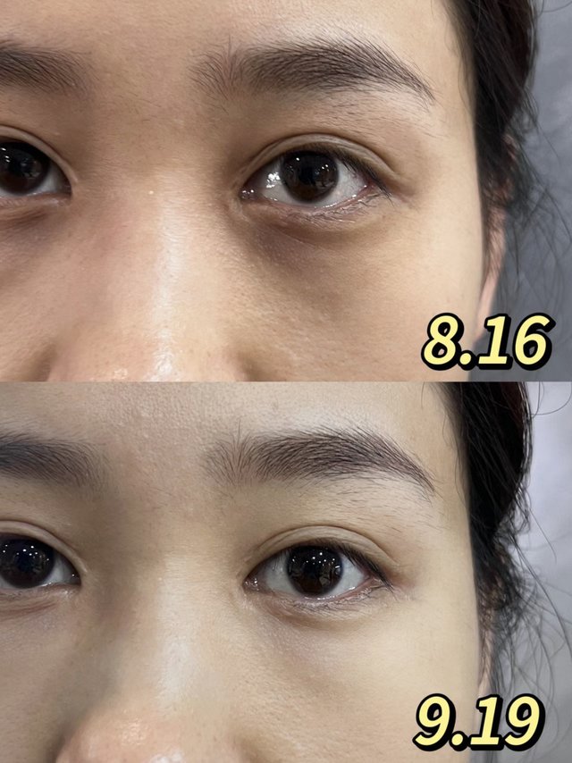 这玩意对黑眼圈杀疯了！！