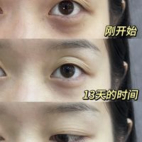 才试34天!谁懂啊黑眼圈真没了!