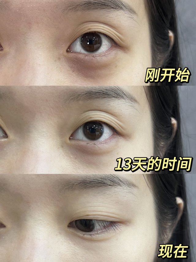 才试34天！谁懂啊黑眼圈真没了！