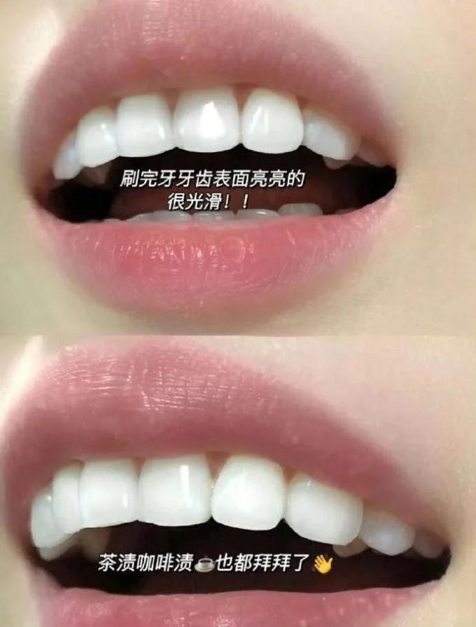 狮王牙膏