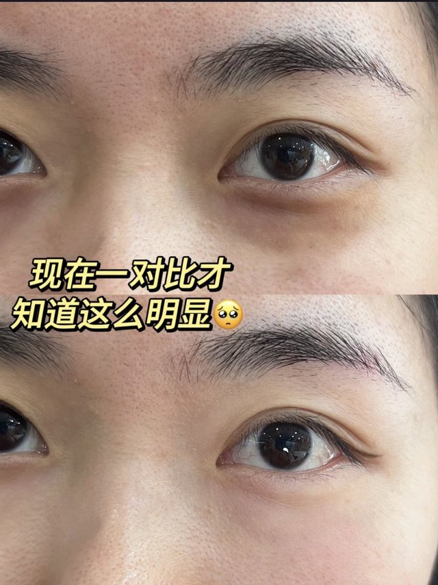 啥原理啊！代谢提高了七七八八成（黑眼圈篇）