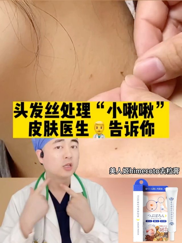 脖子上长“小肉疙瘩”怎么办？这个视频告诉你