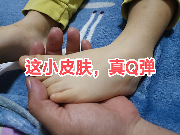 这👶🏻👶🏻👶🏻小皮肤真的很Q弹