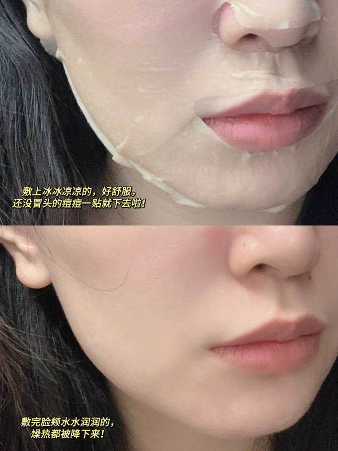 敷尔佳面膜贴