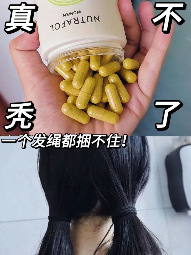 秃头女孩自救成功❗发量富婆就是我