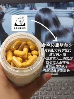 还有脱发星人不知道这个吗