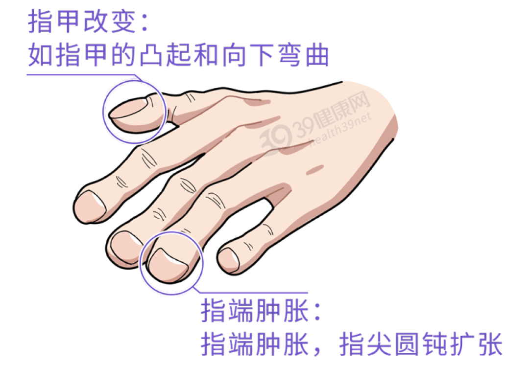 肝受伤,脸先知?身体出现这6种异常,可能是疾病预警