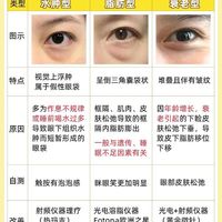 不开刀祛眼袋