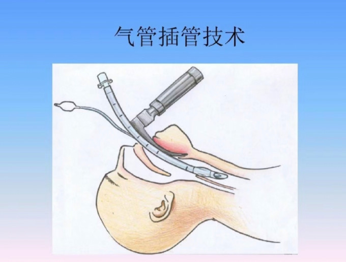 瑞迈特呼吸机