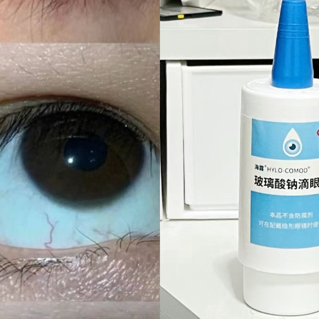 干眼症是什么造成的？得了该怎么做？