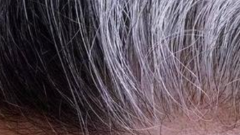 怎样调理白头发最有效的方法？汇总11大养发技巧！