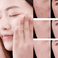 中国祛斑十大名牌，什么护肤品祛斑美白效果好？祛斑真的靠谱