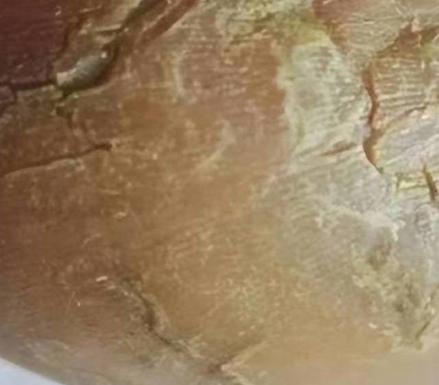 手足皲裂不要怕！高性价比治疗方法大揭秘，皮肤瞬间光滑娇嫩！