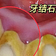 牙缝里的牙结石引发口臭怎么办？我只用了2个月，就彻底搞定了！
