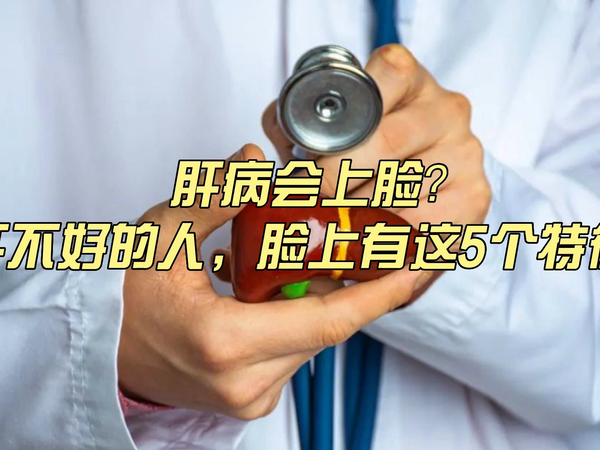 肝不好的人，脸上多有这5个特征！